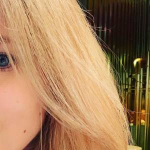 Aktorka "Pierwszej miłości" oszpecona przez psa. Pokazała blizny na twarzy po pogryzieniu