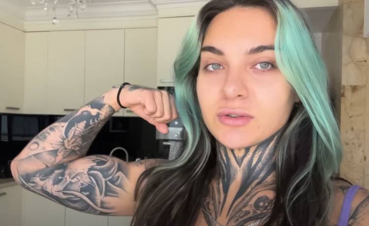 Sheeya po operacji plastycznej. Jak wygląda?