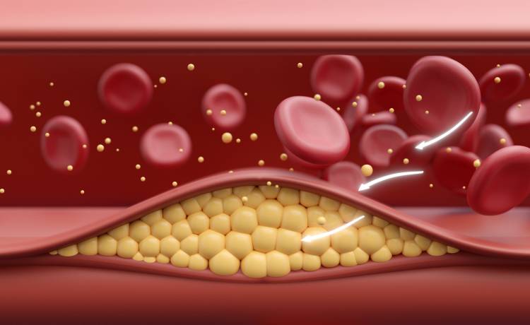 fot. shutterstock.com