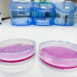 Jej nieśmiertelne komórki do dziś ratują ludzkie życia. Henrietta Lacks zmarła 70 lat temu 