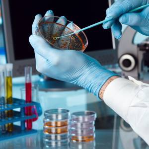 Miażdżący raport! Uśmiercają aż 1,2 mln ludzi rocznie na świecie. Są odporne na antybiotyki 