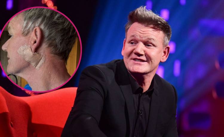 fot. Matt Crossick/Press Association/East News; Instagram @gordongram