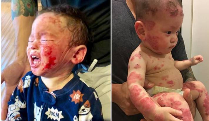 Dziecko straszliwie cierpiało. Nikt nie wiedział, co mu jest!
