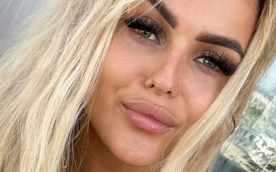 Uczestniczka "Love Island" tuż po operacji nosa. Jagoda zaprezentowała nos i opuchniętą twarz