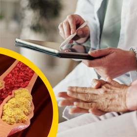 Wysoki cholesterol nie boli. To jedyny sposób, by sprawdzić jego poziom