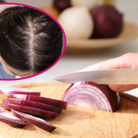 Domowa wcierka z cebuli na porost włosów naprawdę działa? Ekspertka nie pozostawia wątpliwości