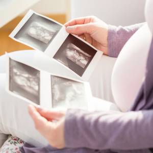 Ten kadr z USG zszokował lekarzy! Zdjęcie z badania trafiło do sieci 