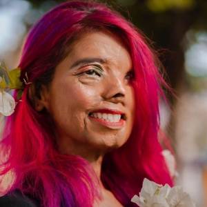 Kiedy miała dwa miesiące, ojciec oblał ją kwasem. Dziś Anmol Rodriguez robi karierę modelki!