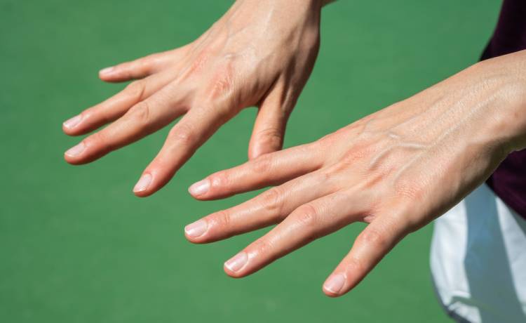 Widoczne żyły na dłoniach, fot. Shutterstock