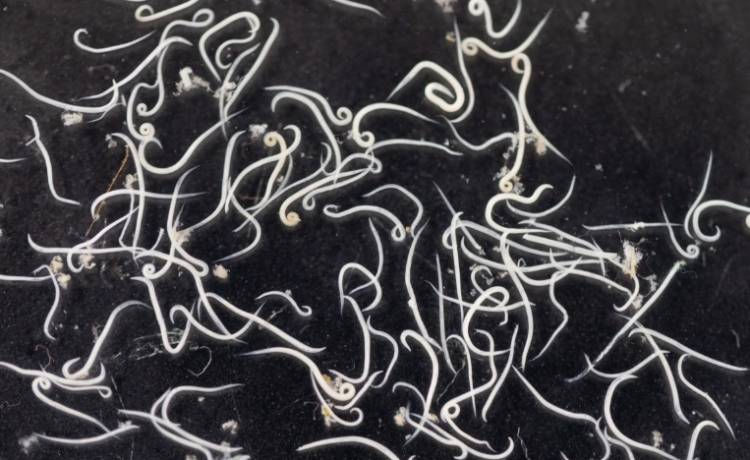 W jego mózgu znaleleziono larwy tasiemca. 18-latek zamarł dwa tygodnie po tym, jak trafił do szpitala