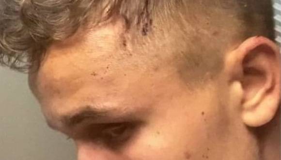 "Hotel Paradise 2". Sprawcą pobicia Łukasza inny uczestnik? Kolega z programu przerwał milczenie