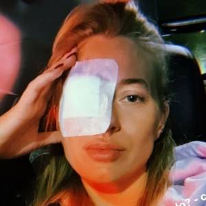 Marcelina Zawadzka trafiła do szpitala. Wszystko przez popularny zabieg upiększający [FOTO]