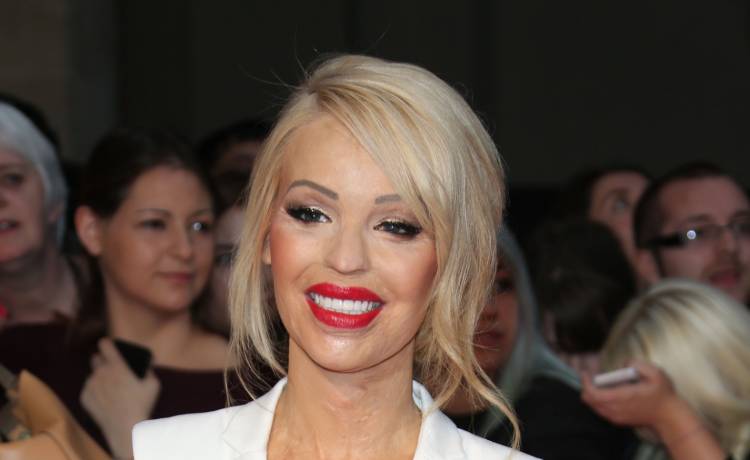 Została oblana kwasem z zazdrości. Przeszła dziesiątki operacji, miałą dziurę w oku