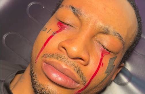Ten tatuaż na twarzy zaskoczył internautów! Mężczyzna zrobił sobie krwawe łzy [WIDEO]